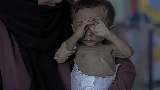 7 aylık bebek ölümün eşiğinde!