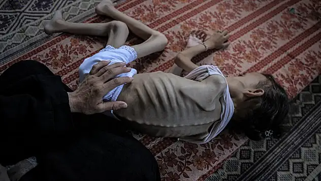 Açlıktan hayatını kaybedenlerin sayısı 263'e yükseldi