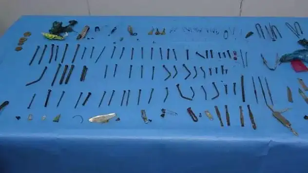 Anahtar, çakı, meyve bıçağı... Midesinden çıkanlar şoke etti