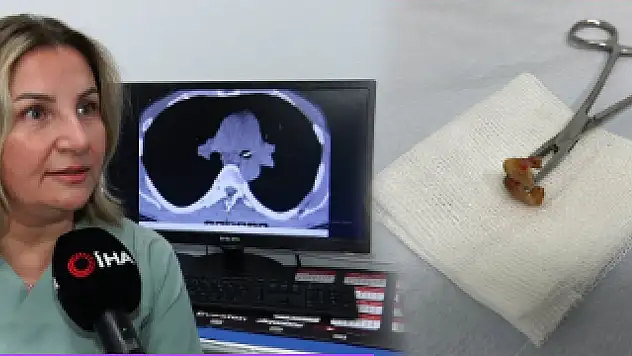 Bunu da gördük ya ! Uykusunda dişlerini yuttu