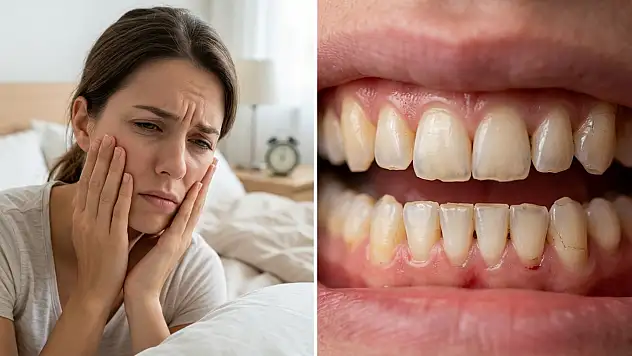Diş sıkıyorsanız vücudunuz size ne anlatıyor? İşte uzmanından tavsiyeler
