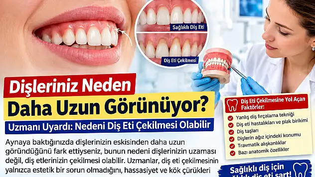 Dişleriniz neden daha uzun görünüyor? Uzmanı uyardı: Nedeni diş eti çekilmesi olabilir
