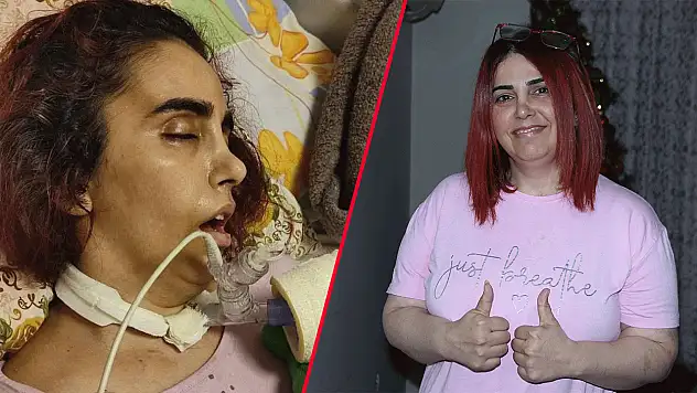 Doktorların umutsuz baktığı kadın, Konya'daki tedaviyle adım adım geri döndü