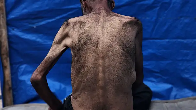 Gazze'de açlıkla mücadele: 75 yaşındaki Hasan Ebu Seble hayatta kalma savaşı veriyor