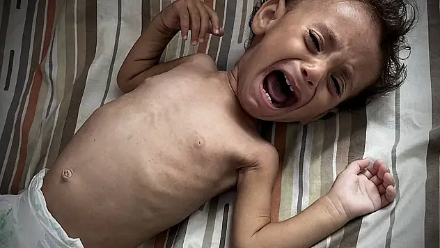 Gazze'de bebekler açlıkla mücade ediyor