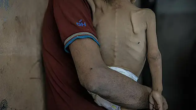 Gazze'de bir çocuk daha açlıktan hayatını kaybetti