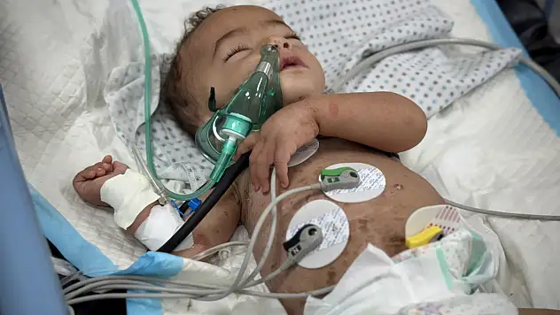 Gazze'de çocuklar açıkla mücadele ediyor!