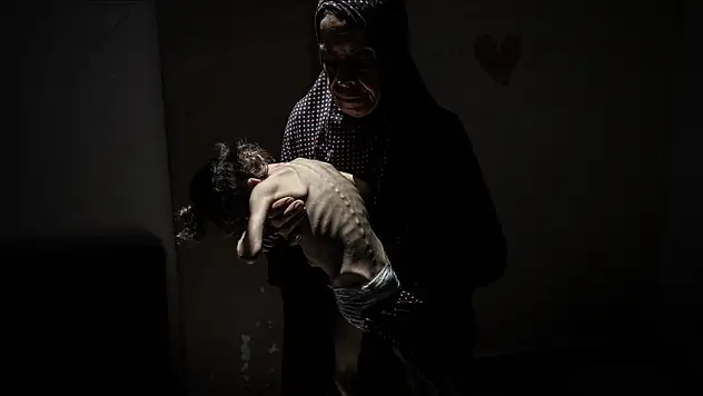 Gazze'de son 24 saatte 10 kişi daha açlıktan hayatını kaybetti