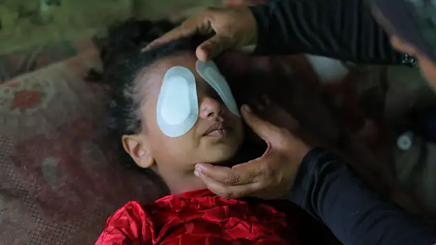 Gözüne şarapnel isabet eden çocuk, görme yetisini kaybetme korkusu yaşıyor