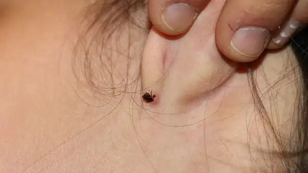 Havaların ısınmasıyla kene tehlikesi başladı