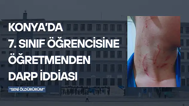Konya'da 7. sınıf öğrencisine öğretmenden darp iddiası: 'Seni öldürürüm'