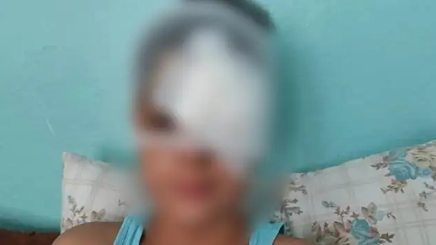 Köpek saldırısından kaçan çocuğa otomobil çarptı