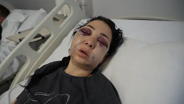 'Küfür etmeyin' dediler, hayatları karardı: Oğlunun gözü önünde anneyi öldüresiye dövdüler