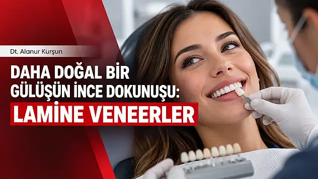 Lamine Veneer nedir, kimlere uygulanır, ömrü ne kadar? Doğal bir gülüş için dikkat edilmesi gerekenler