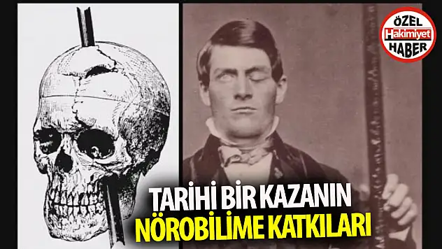 Phineas Gage: Tarihi Bir Kazanın Nörobilime Katkıları