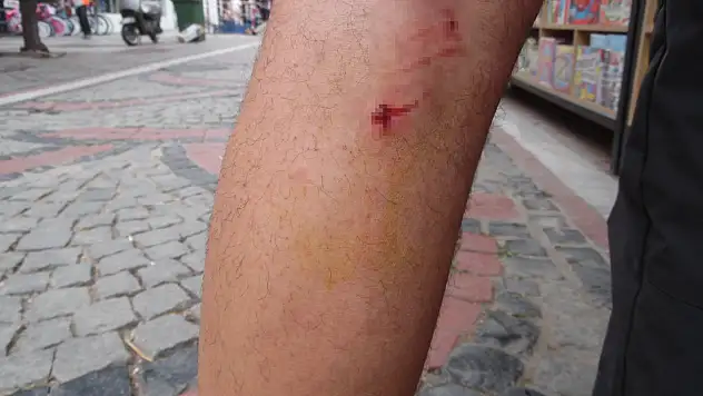 Sokak ortasında dehşet: 8 köpek, vatandaşa saldırdı