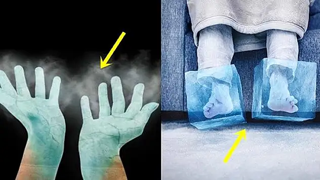 Sürekli üşüyen eller ve ayaklar hastalığın habercisi olabilir!