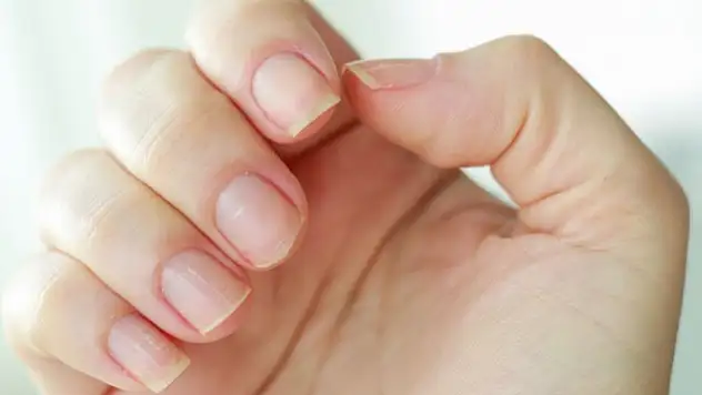 Tırnaklarınızda bu belirti varsa dikkat: Akciğer kanseri habercisi olabilir!