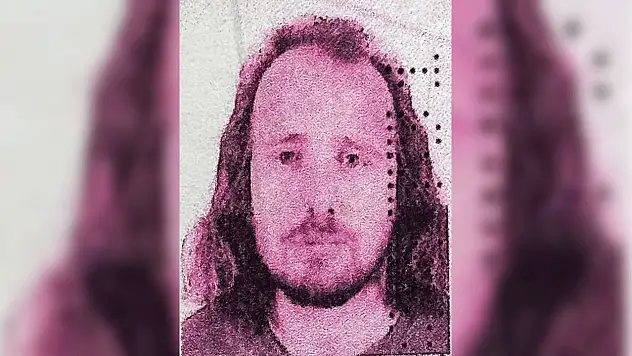 Türkiye'de saç ektirip dişlerini yaptıran turist, operasyonların ardından öldü