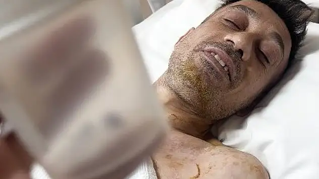 Vücudunda mermiyle geçen 18 yıl: Kurşun çıkarıldı, ilk kez uyudu