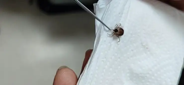5 yaşındaki çocuğun kulağındaki ağrının nedeni şoke etti! Doktor canlı canlı çıkardı