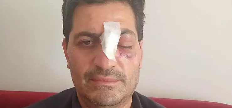 Cami avlusundaki uyarı kavgaya dönüştü: Müezzinin burnu kırıldı