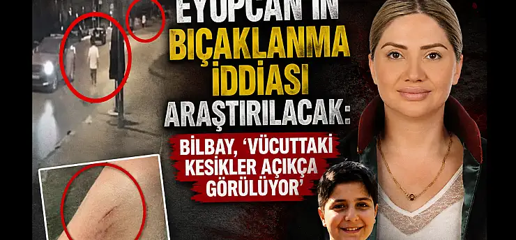 Eyüpcan'ın bıçaklanma iddiası araştırılacak: Bilbay, 'Vücuttaki kesikler açıkça görülüyor'