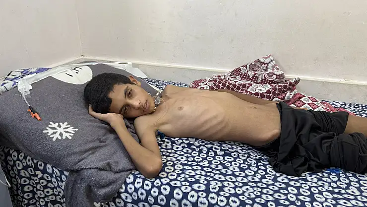 13 yaşındaki çocuk yaşam mücadelesi veriyor