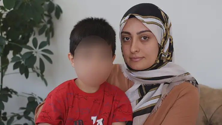 5 yaşındaki çocuğun ameliyatı kabusa döndü: Dili ve dudağını yakmışlar