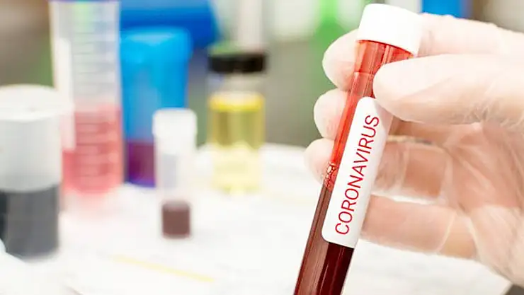 Turizm Bakanı Antalya'nın koronavirüs yeni vaka ve toplam vaka sayısını açıkladı