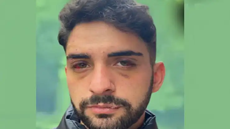 'Korna çaldın' diyerek öldüresiye dövdüler