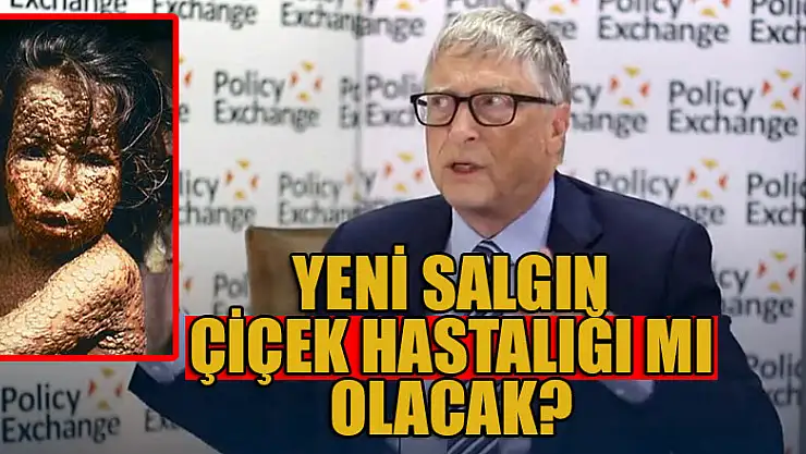 Yeni salgın Çiçek hastalığı mı olacak?