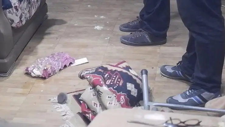 Yumurta pişirirken kendini yaktı!