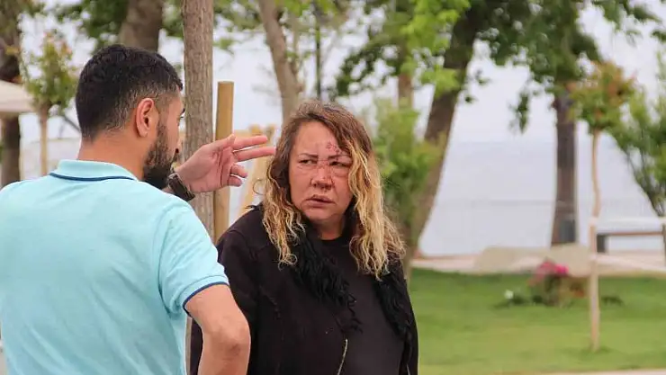 Darp edilmiş olarak yardım isteyen Rus kadın hastaneye kaldırıldı