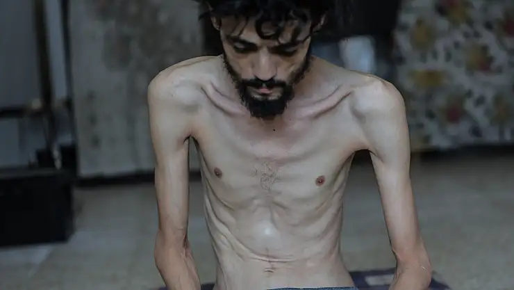 Açlık krizi gün geçtikçe derinleşiyor!