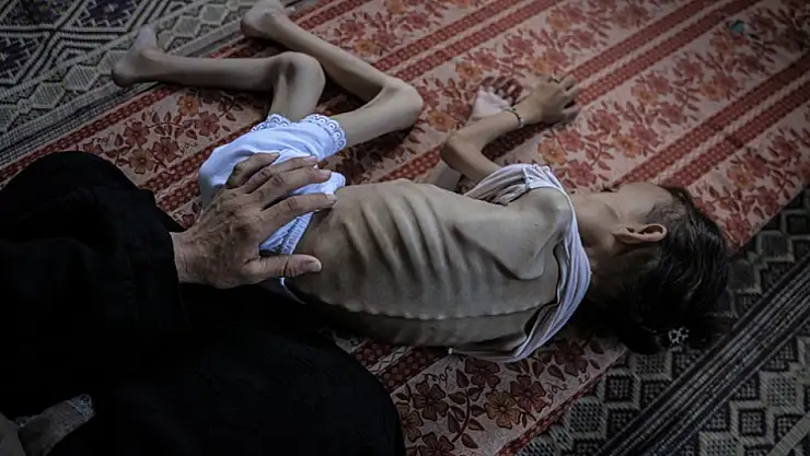 Açlıktan hayatını kaybedenlerin sayısı 263'e yükseldi