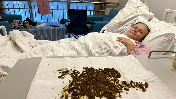 Ağrıyla gitti, rekorla çıktı! Doktorlar bile sayamadı