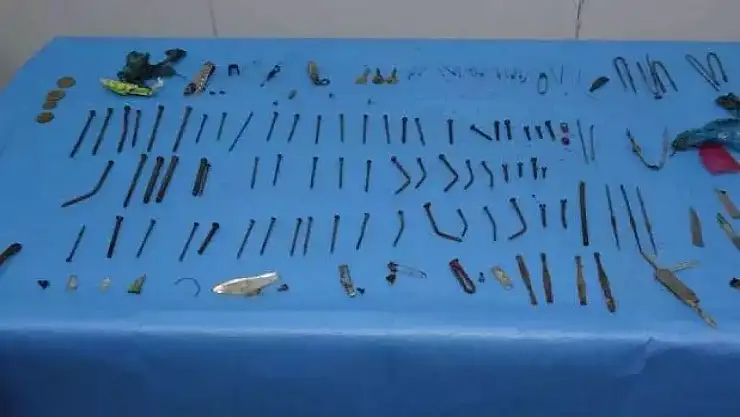 Anahtar, çakı, meyve bıçağı... Midesinden çıkanlar şoke etti