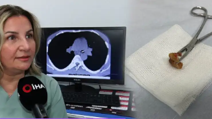 Bunu da gördük ya ! Uykusunda dişlerini yuttu