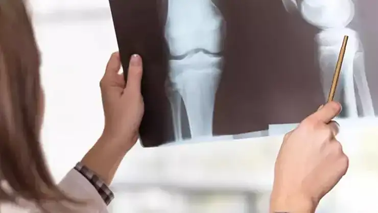 Çocuklarda Kemik Sağlığına Dikkat!