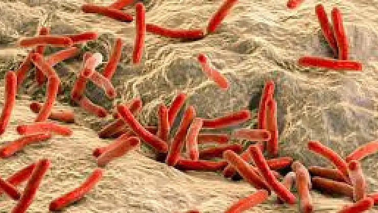 Cüzam Hastalığı: Modern Çağda Tedavi ve Farkındalık