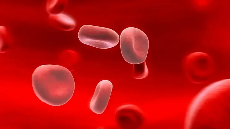 Demir eksikliği: Nedir, Nedeni ve Belirtileri