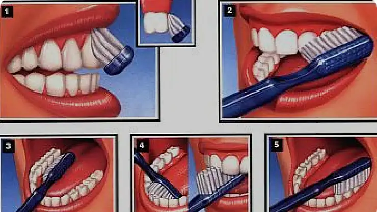 Diş sağlığını olumsuz yönde etkileyen doğru bilinen yanlışlar