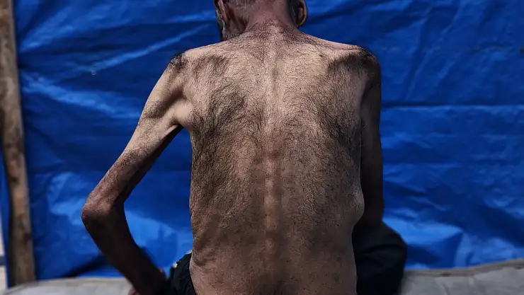 Gazze'de açlıkla mücadele: 75 yaşındaki Hasan Ebu Seble hayatta kalma savaşı veriyor