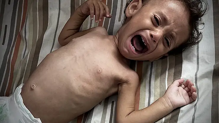 Gazze'de bebekler açlıkla mücade ediyor