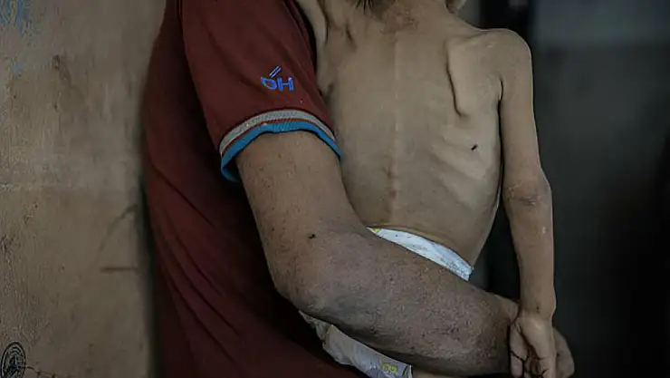 Gazze'de bir çocuk daha açlıktan hayatını kaybetti