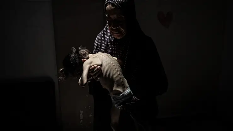 Gazze'de son 24 saatte 10 kişi daha açlıktan hayatını kaybetti