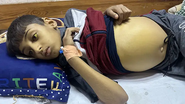 Gazzeli Çocuk, yaşam mücadelesi veriyor