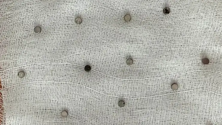 Gittikleri hastanede şoku yaşadılar: Çocuğun boğazından 19 mıknatıs çıktı!