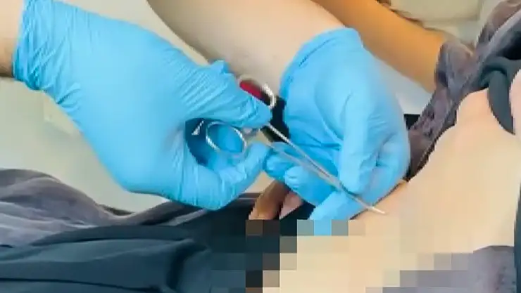 Halsizlik şikayeti için hastaneye gitti karnından kene çıktı